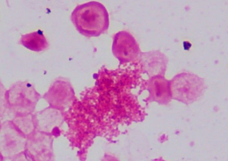 微生物宇宙 | 残疾、流产、生物武器：臭名昭著的布鲁氏菌