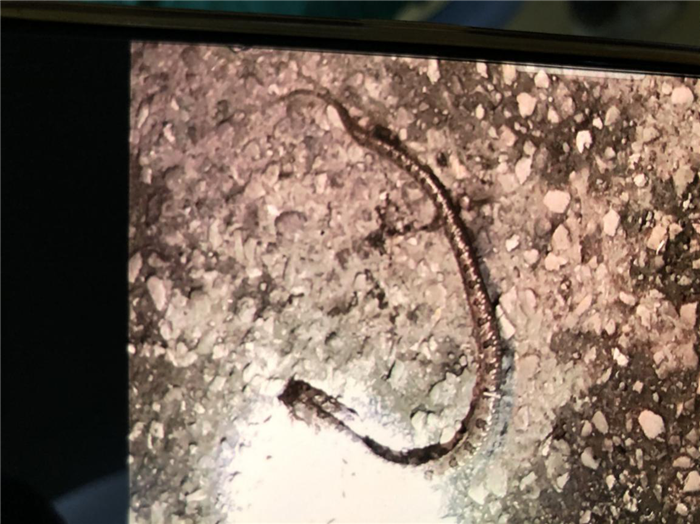 毒蛇竟“从天而降”咬伤司机 我院急诊专家教你毒蛇咬伤急救指南