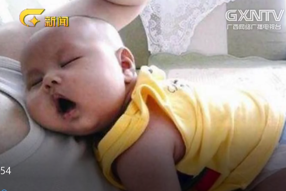 《医科全说》第五十四：孩子睡觉打呼噜？也许是得了儿童阻塞性睡眠呼吸障碍