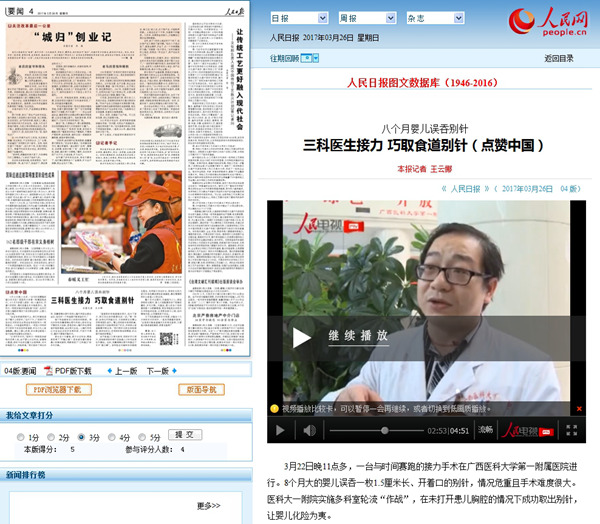 人民日报：八个月婴儿误吞别针 三科医生接力 巧取食道别针（点赞中国）