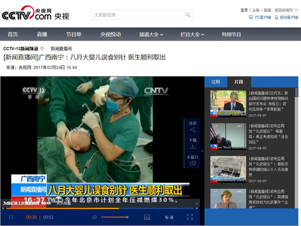 央视新闻、广西台、南宁台10多家媒体记者报道我院医务人员联手接力救治八月大婴儿误吞别针