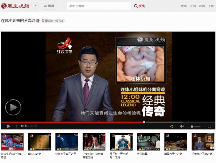 江西卫视《经典传奇》编辑报道我院成功分离连体小姐妹