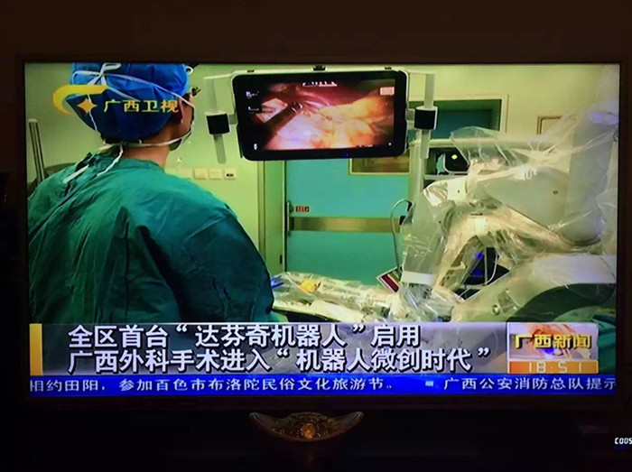 广西新闻、南国早报、新华网等各级媒体关注报到广西首台“达芬奇机器人”在我院正式启用
