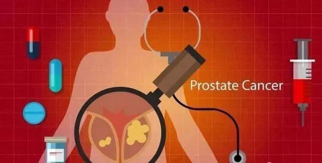 70岁老人早癌难诊难治,多学科融合新技术一“招”致胜!这种癌又小又会伪装