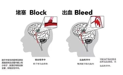 构筑坚强防线，守护大脑健康|《医科全说》正在播出