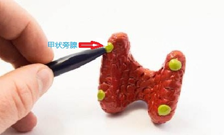 极易误诊漏诊！“骨头痛”竟由甲状旁腺引起，我院多学科联合解决疑难病