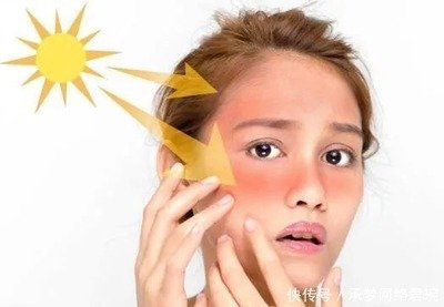 夏季皮肤爱出问题，专家：不存在的，不信你看