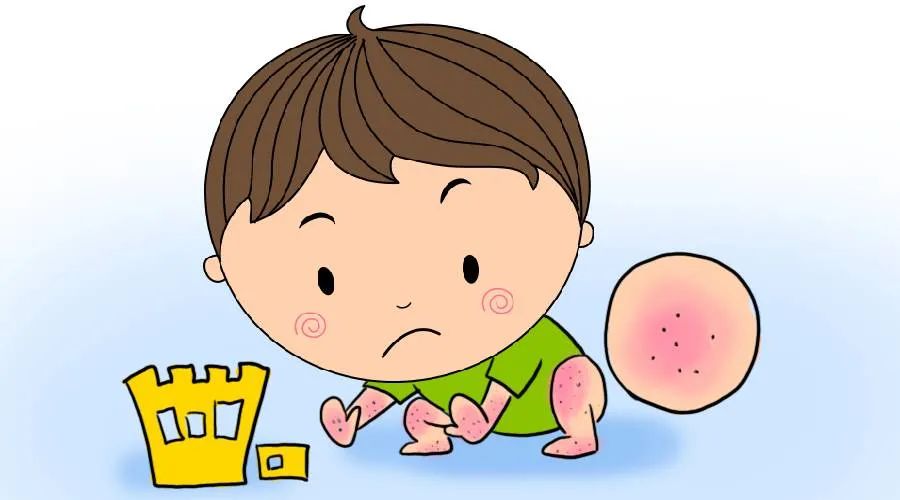 “激素恐惧”？宝宝究竟能不能用？来听专家怎么讲