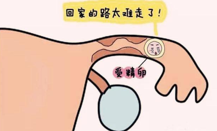 输卵管堵了怎么办？做造影检查痛不痛？