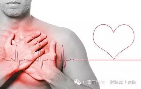 2天6例急性心梗！胸痛中心团队77分钟抢救让患者“躲过一劫”