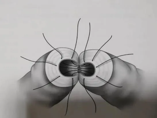 男子已结扎十几年，还能再要二胎吗？泌尿外科日间手术解“男”题