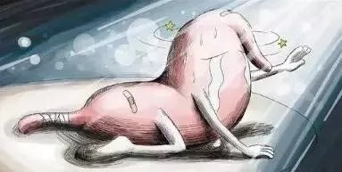 术后“胃瘫”1个月都治不好，她难受到抑郁，结果……