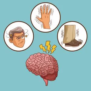 与帕共舞|全麻下脑深部电刺激（DBS）疗法帮助老教师控制帕金森症状，顺利重返讲台