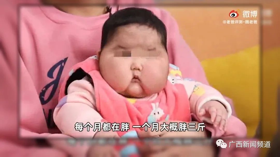 可怕！网曝婴儿用抑菌霜成“大头娃娃”！含激素类的外用药能不能用？