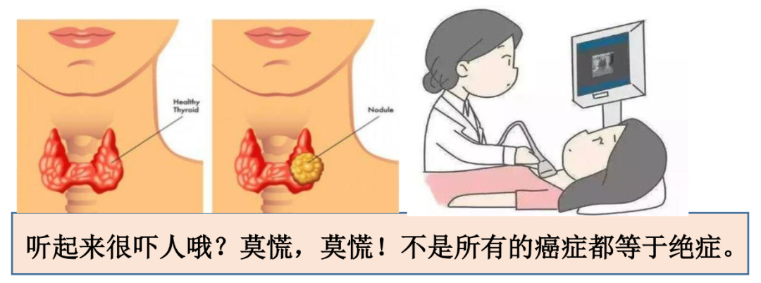 不必谈“癌”色变！甲状腺癌可治愈