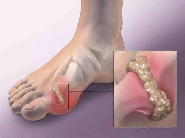 世界第一痛，比女人生孩子还痛？！您知道是什么病？【听音频】