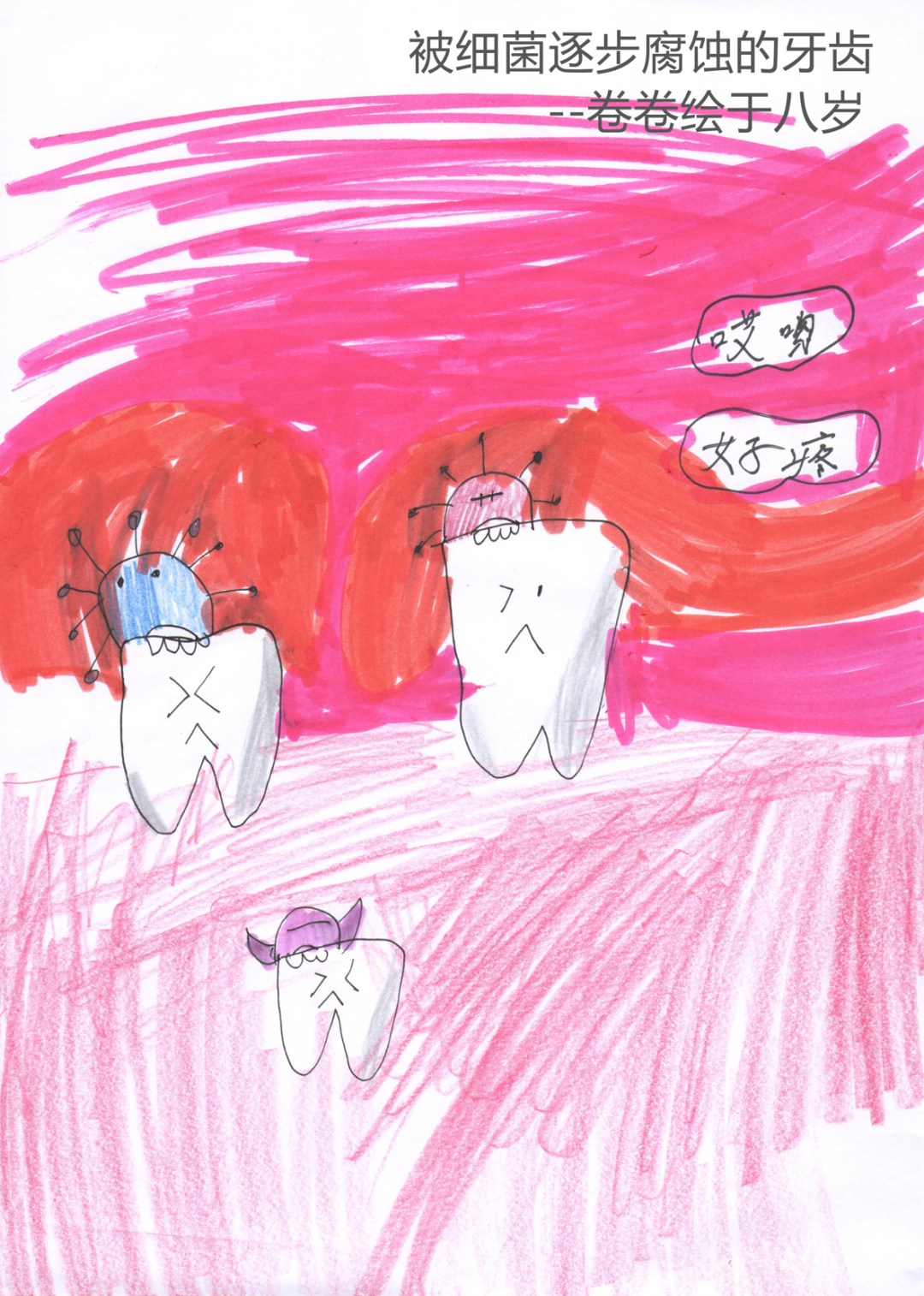 小女孩与药师爸爸的对话:牙齿为什么会烂掉?牙疼时儿童能吃什么药?
