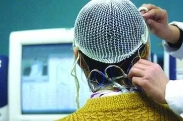 别慌！羊癫疯是可控的，患者也能跟正常人一样！这些基本常识你得懂