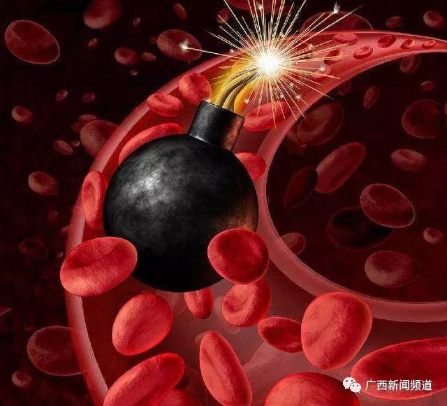 血脂异常升高，危险如影相随 | 医科全说
