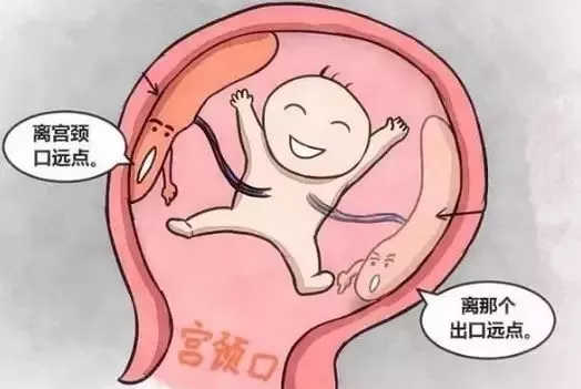 当准妈妈遭遇前置胎盘要知道的事