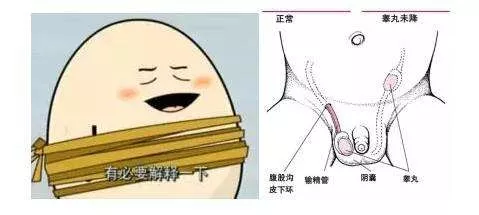 隐睾影响男孩未来生育能力，医生：及时治疗