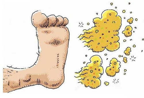 【医科全说】灰指甲、手癣、体癣、脚气……怎么治？敬请围观