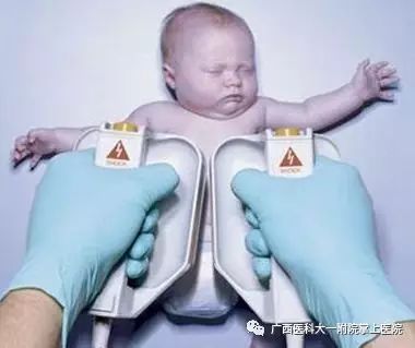 【医科全说】警惕先天性心脏病，宝宝胚胎期最好查查小心脏
