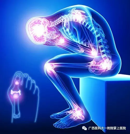 【医科全说】全国1.2亿人饱受“不死癌症”骨关节炎折磨，预防要趁早
