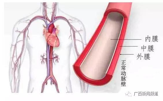 【医科全说】“人体血管爆炸！”——警惕凶险的主动脉夹层