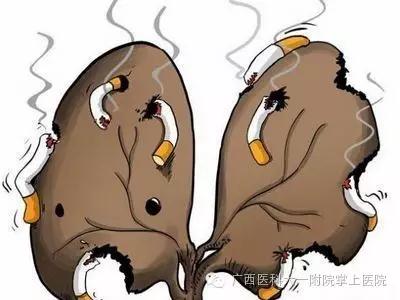烟民易“恋上”慢性阻塞性肺疾病（慢阻肺），不要等到严重了才就医