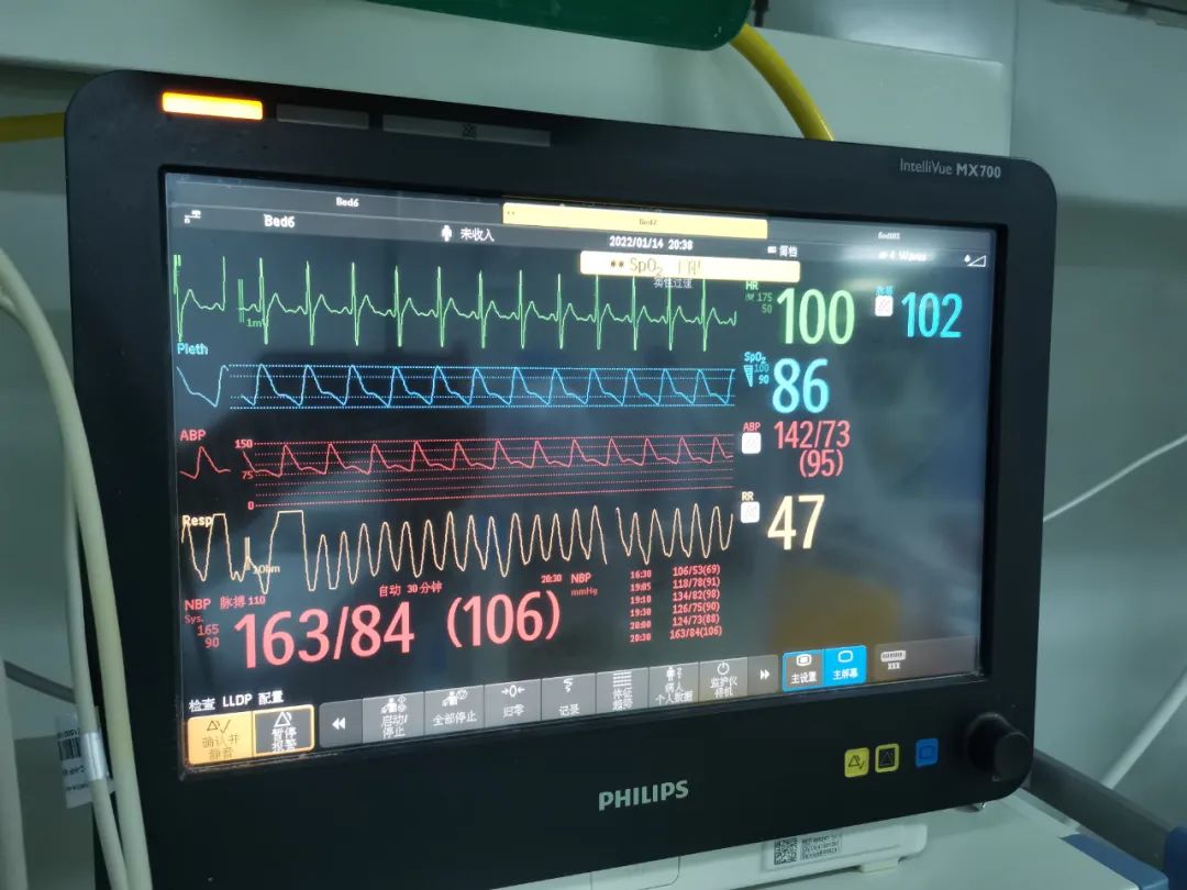 男子突发高热不退住进ICU，竟是感染“鹦鹉热”！专家提醒：此病极易误诊