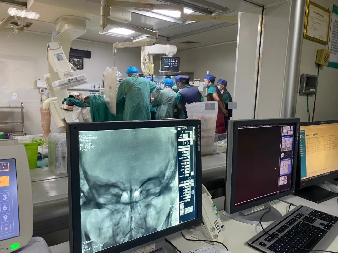 神经内科联合多学科团队成功救治急性期基底动脉尖栓塞脑梗死患者