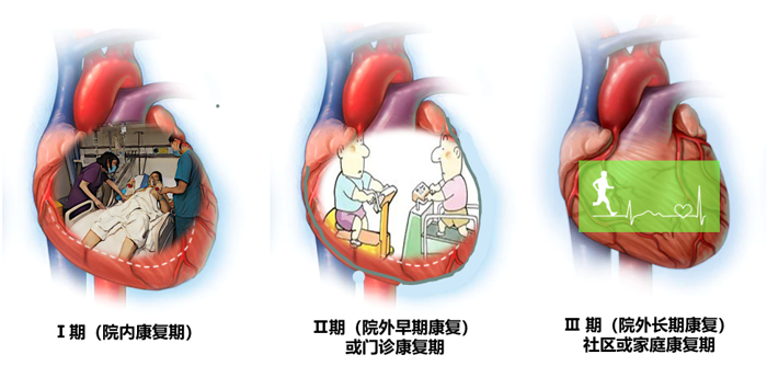 心脏也可以进行康复锻炼！谈谈心脏康复那些事