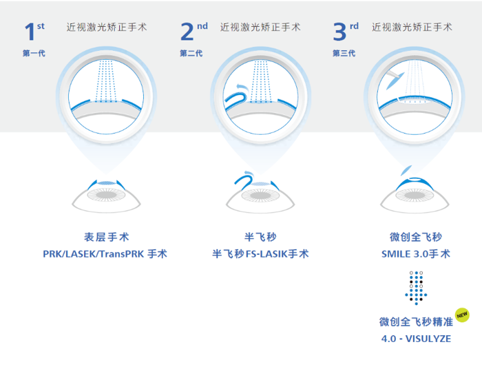 新技术丨微创全飞秒精准4.0-VISULYZE落户广西医科大学第一附属医院眼科