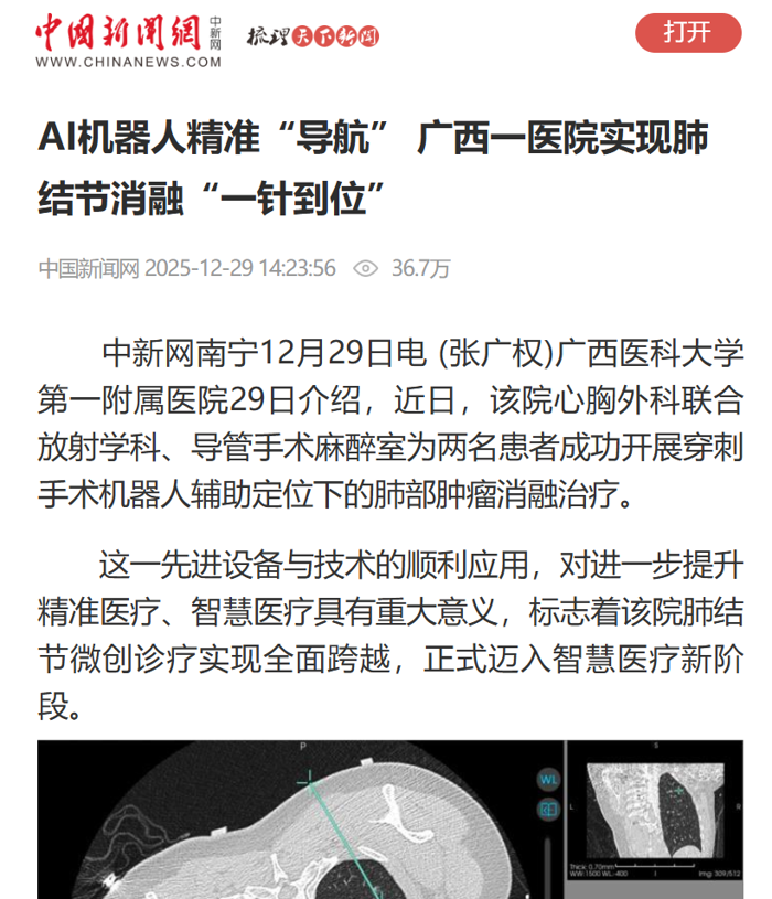 多媒体报道：AI机器人精准“导航” 我院实现肺结节消融“一针到位”