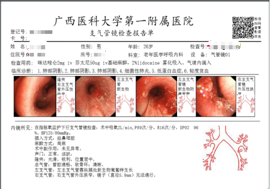 “五一”假期在“医线”呼吸介入打通生命通道｜老年医学呼吸内科紧急救治26岁双侧大气道梗阻患者