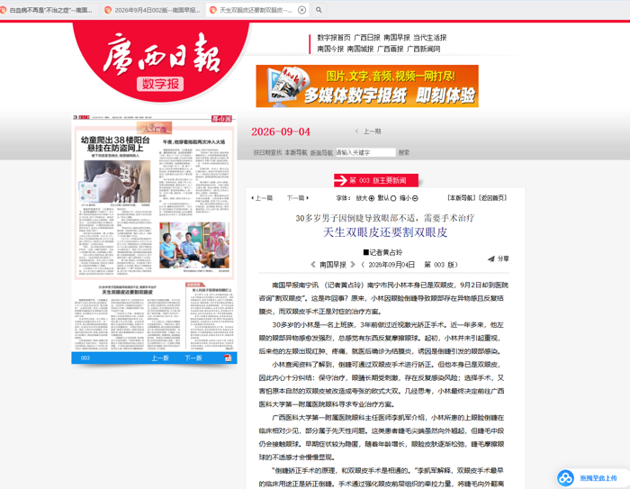 广西日报-南国早报-30多岁男子因倒睫导致眼部不适，需要手术治疗 天生双眼皮还要割双眼皮